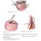 Hinman's Atlas of Urologic Surgery 5th Edition
