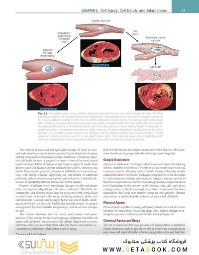 Robbins, Cotran & Kumar Pathologic Basis of Disease (Robbins Pathology) 11th Edition