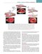 Robbins, Cotran & Kumar Pathologic Basis of Disease (Robbins Pathology) 11th Edition
