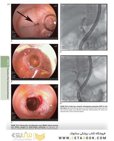 The Principles of Harrison’s Internal Medicine: Gastrointestinal Diseases 2026