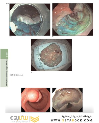 The Principles of Harrison’s Internal Medicine: Gastrointestinal Diseases 2026