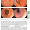 The Principles of Harrison’s Internal Medicine: Gastrointestinal Diseases 2026