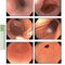 The Principles of Harrison’s Internal Medicine: Gastrointestinal Diseases 2026