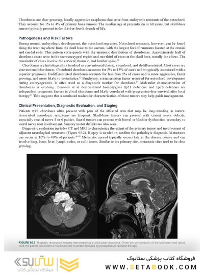 Perez, Brady, Halperin, and Wazer's Principles and Practice of Radiation Oncology Eighth Edition