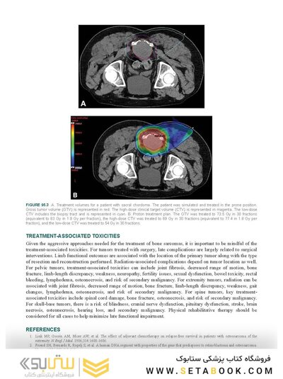 Perez, Brady, Halperin, and Wazer's Principles and Practice of Radiation Oncology Eighth Edition