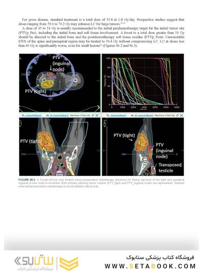 Perez, Brady, Halperin, and Wazer's Principles and Practice of Radiation Oncology Eighth Edition