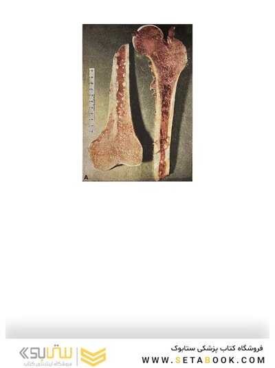 Perez, Brady, Halperin, and Wazer's Principles and Practice of Radiation Oncology Eighth Edition