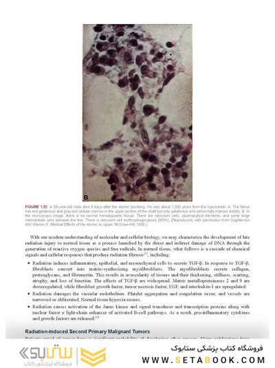Perez, Brady, Halperin, and Wazer's Principles and Practice of Radiation Oncology Eighth Edition
