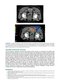 Perez, Brady, Halperin, and Wazer's Principles and Practice of Radiation Oncology Eighth Edition