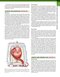 Braunwald’s Heart Disease, 2 Vol Set: A Textbook of Cardiovascular Medicine 13th Edition
