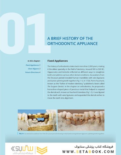 Clear Aligner Technique 2nd Edition