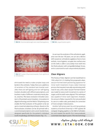 Clear Aligner Technique 2nd Edition