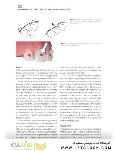 Clear Aligner Technique 2nd Edition