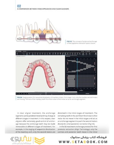 Clear Aligner Technique 2nd Edition