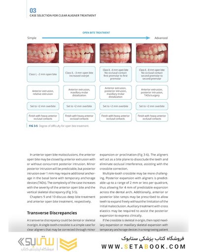 Clear Aligner Technique 2nd Edition