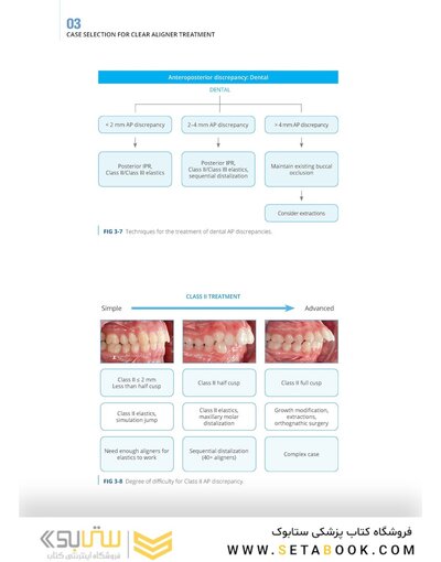Clear Aligner Technique 2nd Edition