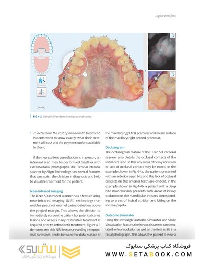 Clear Aligner Technique 2nd Edition