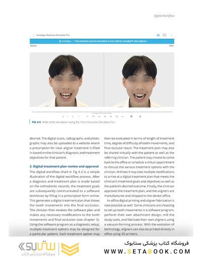 Clear Aligner Technique 2nd Edition