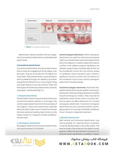 Clear Aligner Technique 2nd Edition