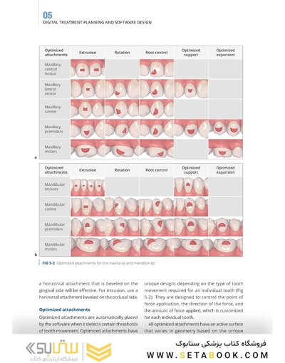 Clear Aligner Technique 2nd Edition