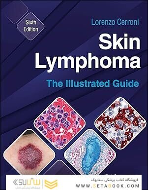 Skin Lymphoma: The Illustrated Guide 6th Edition