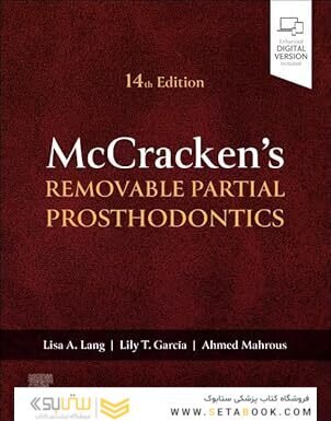 McCracken's Removable Partial Prosthodontics 14th Edition