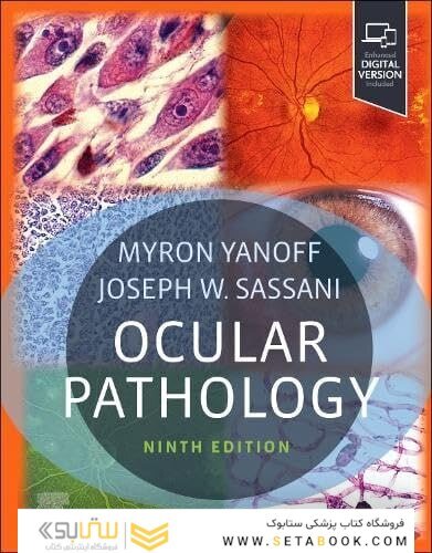 Ocular Pathology 9th Edition