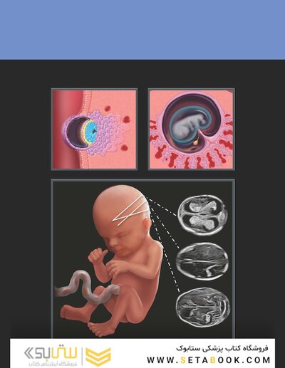 Diagnostic Imaging: Obstetrics 5th Edition