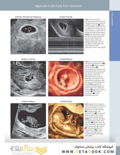 Diagnostic Imaging: Obstetrics 5th Edition