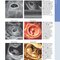 Diagnostic Imaging: Obstetrics 5th Edition