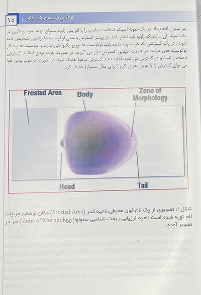 اطلس خون شناسی