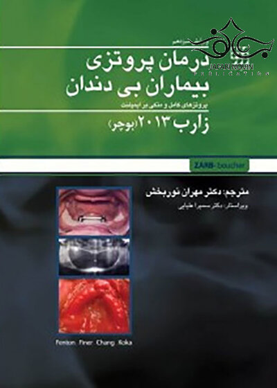 درمان پروتزی بیماران بی دندان زارب بوچر 2013