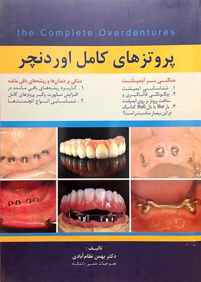پروتزهای کامل اوردنچر