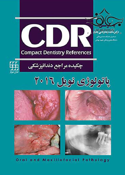 چکیده مراجع دندانپزشکی پاتولوژی نویل 2016