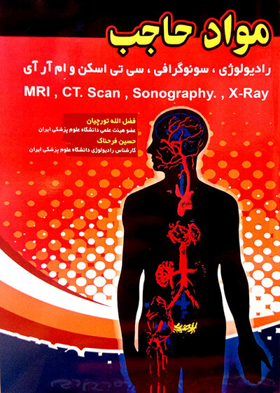 مواد حاجب
