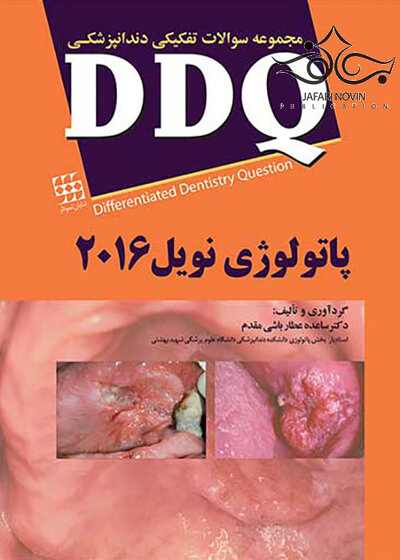 DDQ مجموعه سوالات تفکیکی دندانپزشکی پاتولوژی نویل 2016