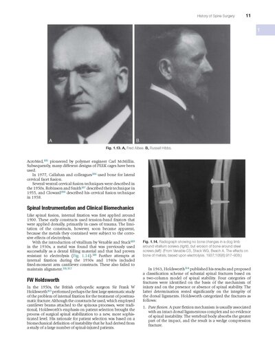 Benzel’s Spine Surgery 5th Edition 2022