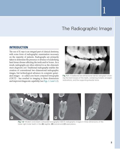 Essentials of Dental Radiography and Radiology 2021