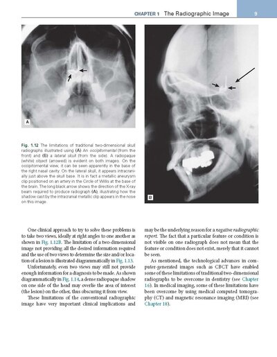 Essentials of Dental Radiography and Radiology 2021