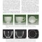 Essentials of Dental Radiography and Radiology 2021