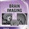 Radiology Case Review Series: Brain Imaging 1st Edition