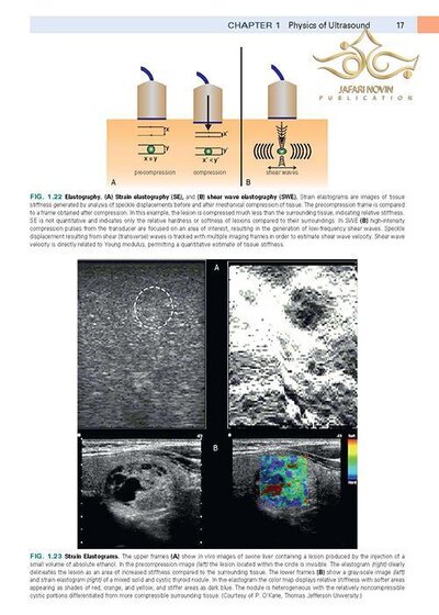 Diagnostic Ultrasound,2018 2-Volume Set 5th Edition