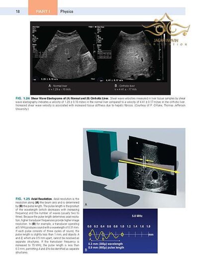Diagnostic Ultrasound,2018 2-Volume Set 5th Edition
