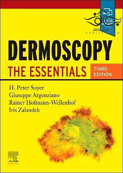Dermoscopy: The Essentials, 3rd Edition