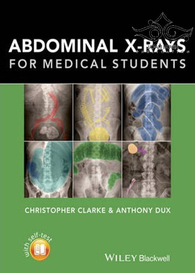 Abdominal X-rays for Medical Student2015