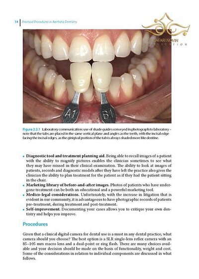 Practical Procedures in Aesthetic Dentistry