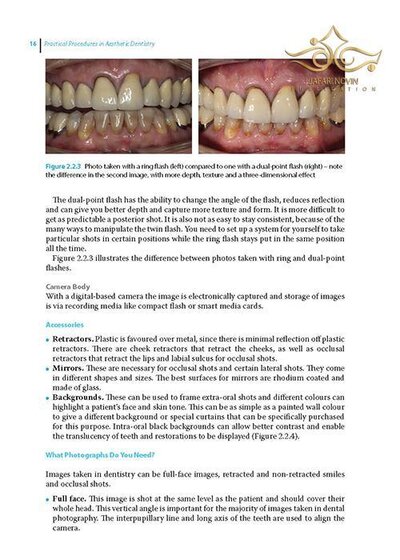 Practical Procedures in Aesthetic Dentistry
