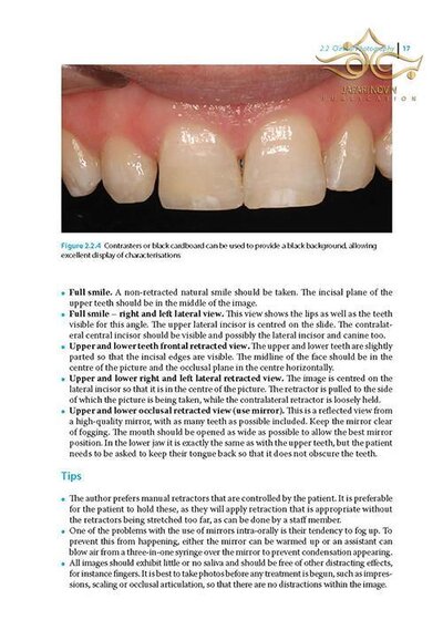Practical Procedures in Aesthetic Dentistry