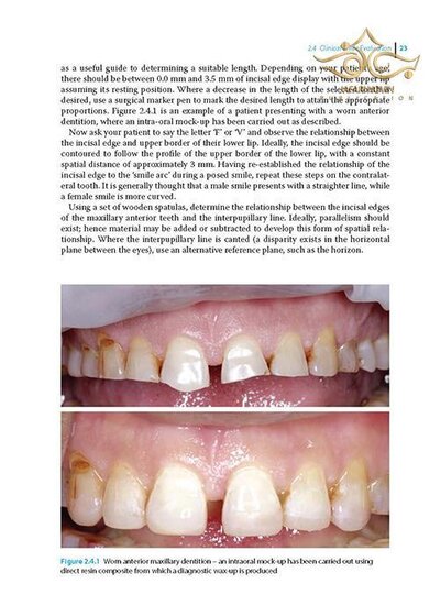 Practical Procedures in Aesthetic Dentistry