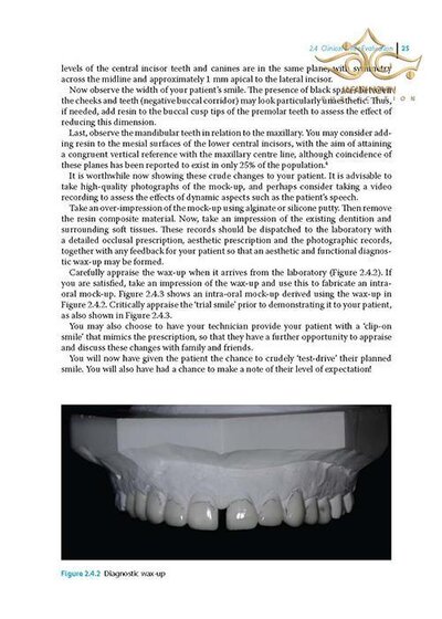 Practical Procedures in Aesthetic Dentistry